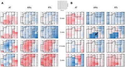 Prolonged repolarization in the early phase of ischemia is associated with ventricular fibrillation development in a porcine model